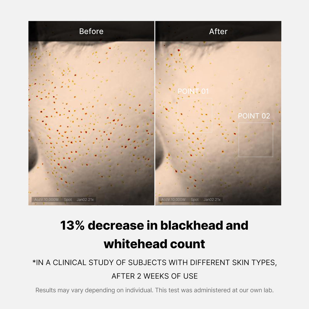 Zero Pore One-day Peptide Serum
